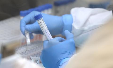 ​SESA confirma primeiro caso de H3N2 em Jacarezinho